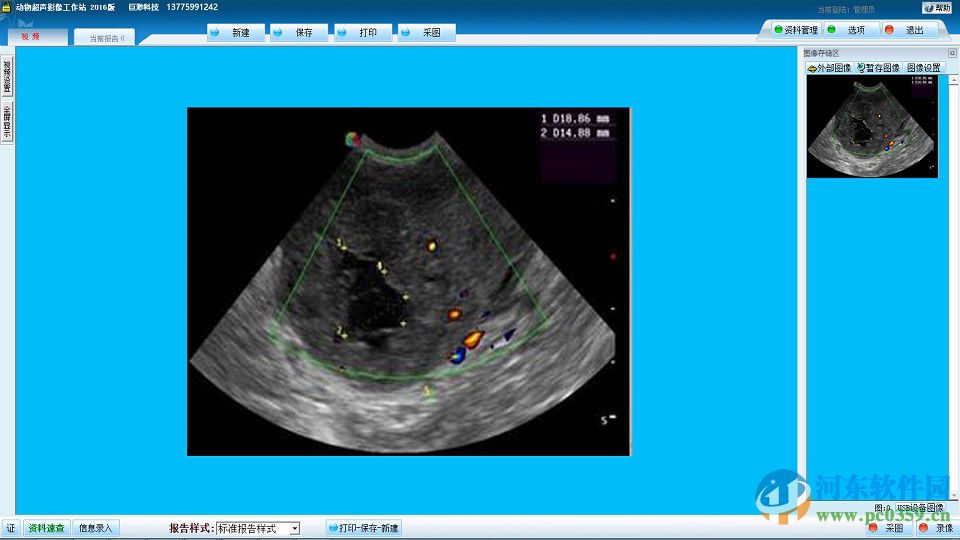 巨渺動物超聲影像工作站 2016 官方版