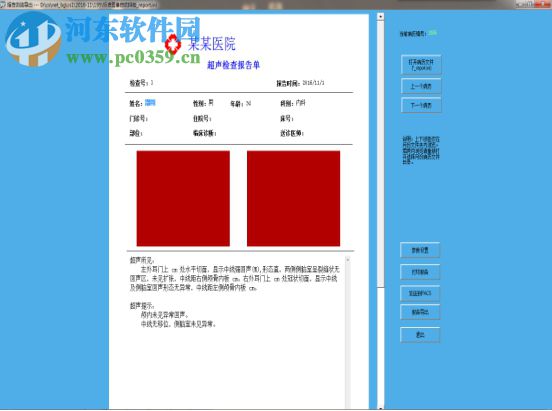 巨渺醫(yī)學(xué)報(bào)告瀏覽器下載 2017 官方版