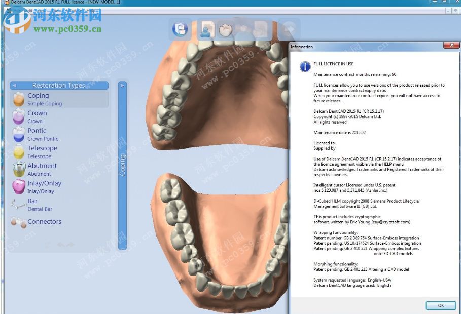 Delcam DentCAD 2015 R1 Win32/64位 免費版