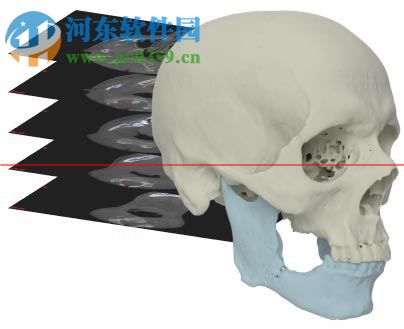 mimics下載 (醫(yī)學圖像處理軟件)  附安裝教程 17.0 中文破解版