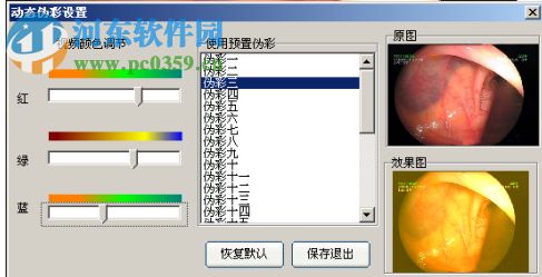 內(nèi)窺鏡影像工作站 13.2 官方版