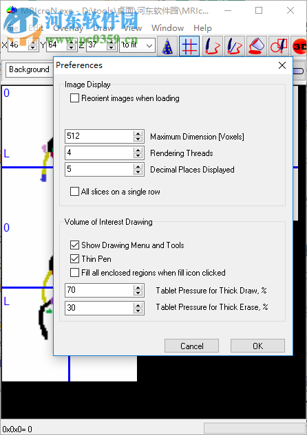 MRIcroN(醫(yī)學(xué)影像分析工具) V4.0 綠色版