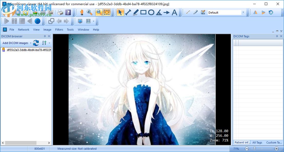 MicroDicom viewer(Dicom格式看圖軟件) 2.9.2 官方版
